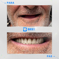 Best Dental Tirana
