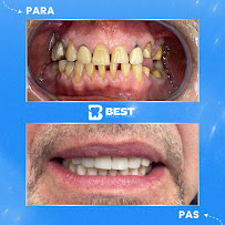 Best Dental Tirana