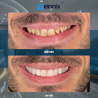 Elonix Dental Clinic