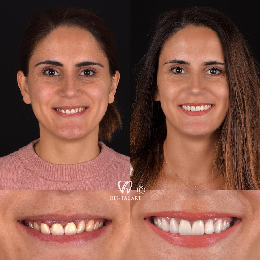 Dental Art Tirana (Dr. Elda Leka Kalemi) - dental clinic in Tirana