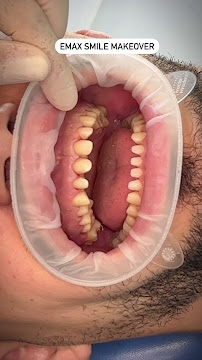 Dental Art Tirana (Dr. Elda Leka Kalemi)
