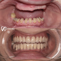 Dental Art Tirana (Dr. Elda Leka Kalemi)