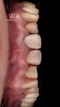 Dental Art Tirana (Dr. Elda Leka Kalemi)