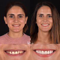 Dental Art Tirana (Dr. Elda Leka Kalemi)