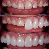 Divino Dental Clinic - Impianti Dentali in Albania