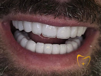 Divino Dental Clinic - Impianti Dentali in Albania