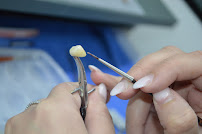 Divino Dental Clinic - Impianti Dentali in Albania