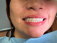 Divino Dental Clinic - Impianti Dentali in Albania