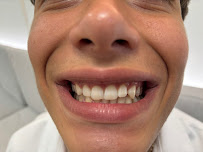 Divino Dental Clinic - Impianti Dentali in Albania