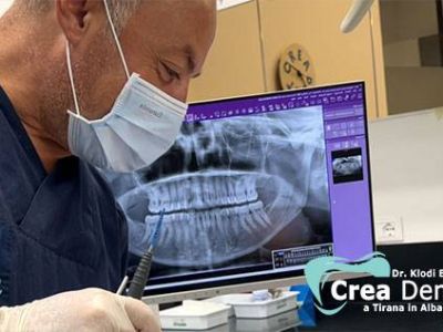 Crea Dent dental equipment in Tirana