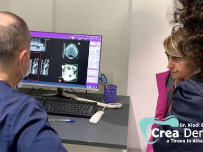 Crea Dent treatment room in Tirana