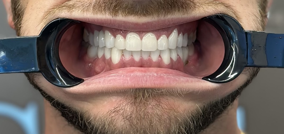 Clinica del Sorriso Tirana - Turismo Dentale in Albania - dental clinic in Tirana, Albania