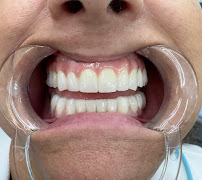 Clinica del Sorriso Tirana - Turismo Dentale in Albania