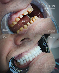 Clinica del Sorriso Tirana - Turismo Dentale in Albania