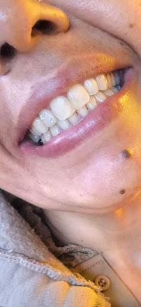 Dentisti in Albania Sorriso a Tirana