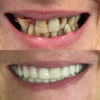 Dentisti in Albania - Andent Clinic