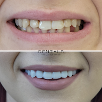 Klinika DENTALB - Dental clinic in Tirana ,Albania