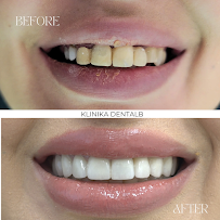 Klinika DENTALB - Dental clinic in Tirana ,Albania