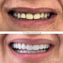 Klinika DENTALB - Dental clinic in Tirana ,Albania