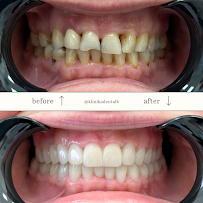 Klinika DENTALB - Dental clinic in Tirana ,Albania