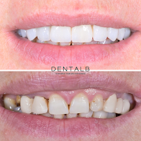 Klinika DENTALB - Dental clinic in Tirana ,Albania