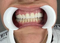 SOS Turismo Dentale Albania