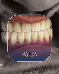 Dentisti in Albania - Clinica Dentale a Tirana - Impianti Dentali - Ortodonzia - Turismo Dentale - Ayna Dental Clinic