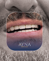 Dentisti in Albania - Clinica Dentale a Tirana - Impianti Dentali - Ortodonzia - Turismo Dentale - Ayna Dental Clinic