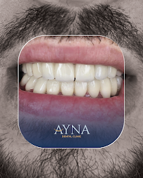 Dentisti in Albania - Clinica Dentale a Tirana - Impianti Dentali - Ortodonzia - Turismo Dentale - Ayna Dental Clinic
