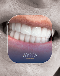 Dentisti in Albania - Clinica Dentale a Tirana - Impianti Dentali - Ortodonzia - Turismo Dentale - Ayna Dental Clinic