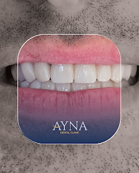 Dentisti in Albania - Clinica Dentale a Tirana - Impianti Dentali - Ortodonzia - Turismo Dentale - Ayna Dental Clinic