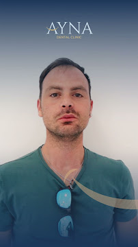 Dentisti in Albania - Clinica Dentale a Tirana - Impianti Dentali - Ortodonzia - Turismo Dentale - Ayna Dental Clinic