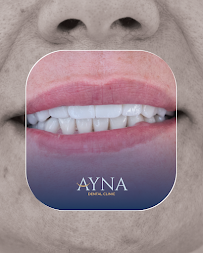 Dentisti in Albania - Clinica Dentale a Tirana - Impianti Dentali - Ortodonzia - Turismo Dentale - Ayna Dental Clinic