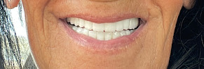 Art Dent Clinic & Laborator - Dental Clinic, Dental Tourism, Clinica Dentale