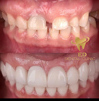 ED Dental Clinic
