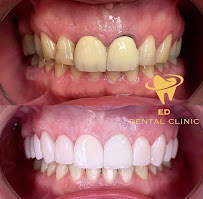 ED Dental Clinic