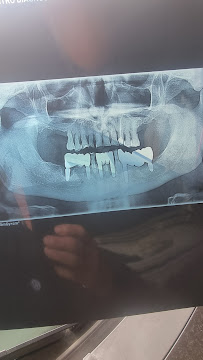 International Dental Clinic - Clinica Dentale Albania, Turismo Dentale