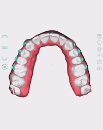 Dental Clinic in Tirana - Idrizi Dental