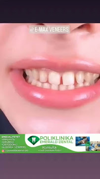 Emerald Dental | Dentista Albania: Dal Volo alla Cura per Denti e Sorrisi