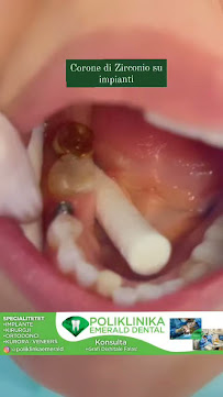 Emerald Dental | Dentista Albania: Dal Volo alla Cura per Denti e Sorrisi