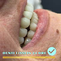 Radiance Dental Hospital - Turismo Dentale in Albania