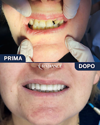 Radiance Dental Hospital - Turismo Dentale in Albania