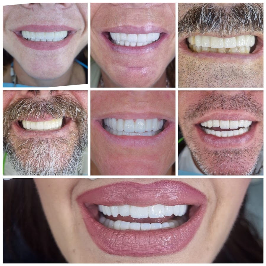 Dentisti in Albania-Biodent - dental clinic in Tirana, Albania