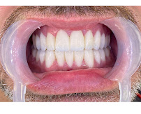 Dentisti in Albania-Biodent