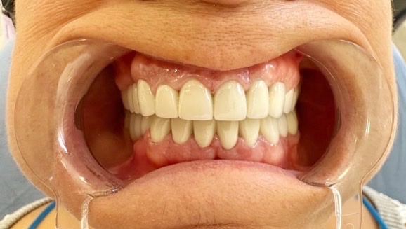 Emma Dental Center - Impianti Dentali in Albania - dental clinic in Tirana, Albania