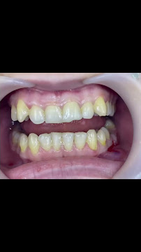 Klinike Dentare Ledismile