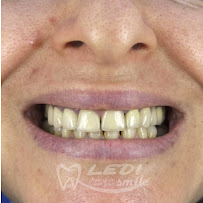 Klinike Dentare Ledismile