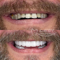 Klinike Dentare Ledismile