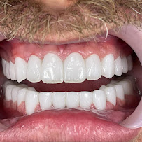 Klinike Dentare Ledismile