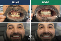 Endo Dental